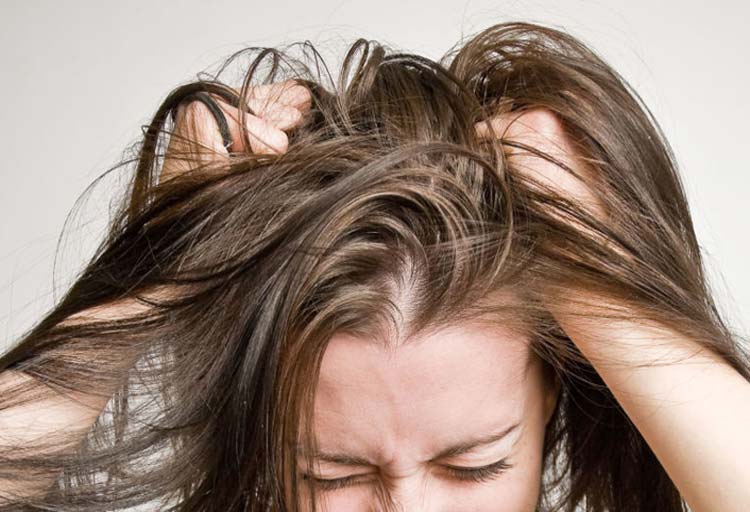 Home Remedies for an Itchy Scalp